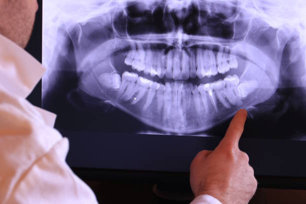 Best Dental Abscess Treatment in Grand Marais, MN